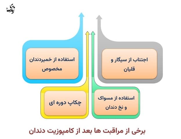 برخی از مراقبت ها بعد از کامپوزیت دندان
