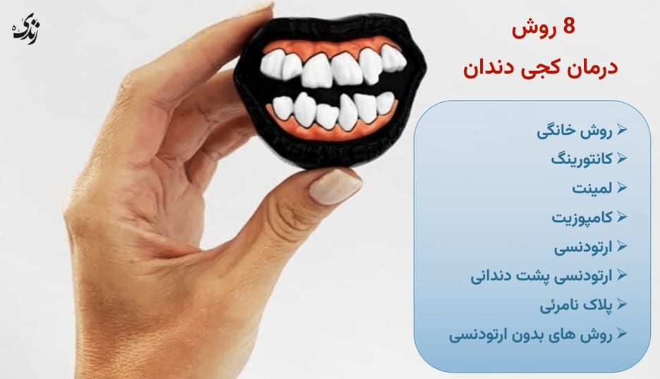 روش های درمان کجی دندان