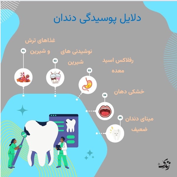 دلایل پوسیدگی دندان