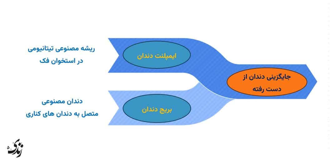 بررسی کلی بریج دندان و ایمپلنت دندان