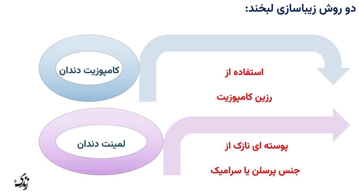 بررسی لمینت و کامپوزیت دندان ها