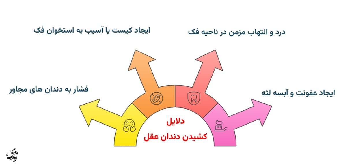 دلایل رایج کشیدن دندان عقل