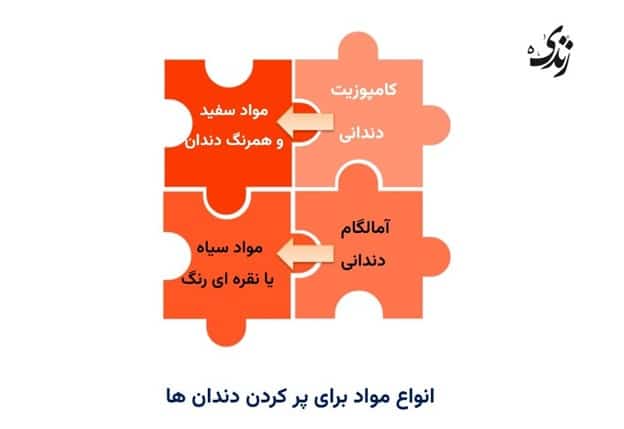 انواع مواد برای پر کردن دندان ها
