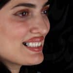 لمینت 29