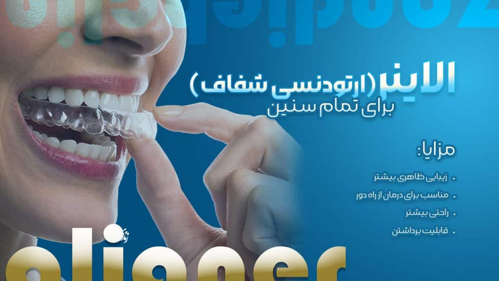 مزیت های ارتودنسی شفاف