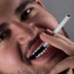 نمونه کار لمینت دندان کلینیک زندیه 37