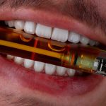 نمونه کار لمینت دندان کلینیک زندیه 38