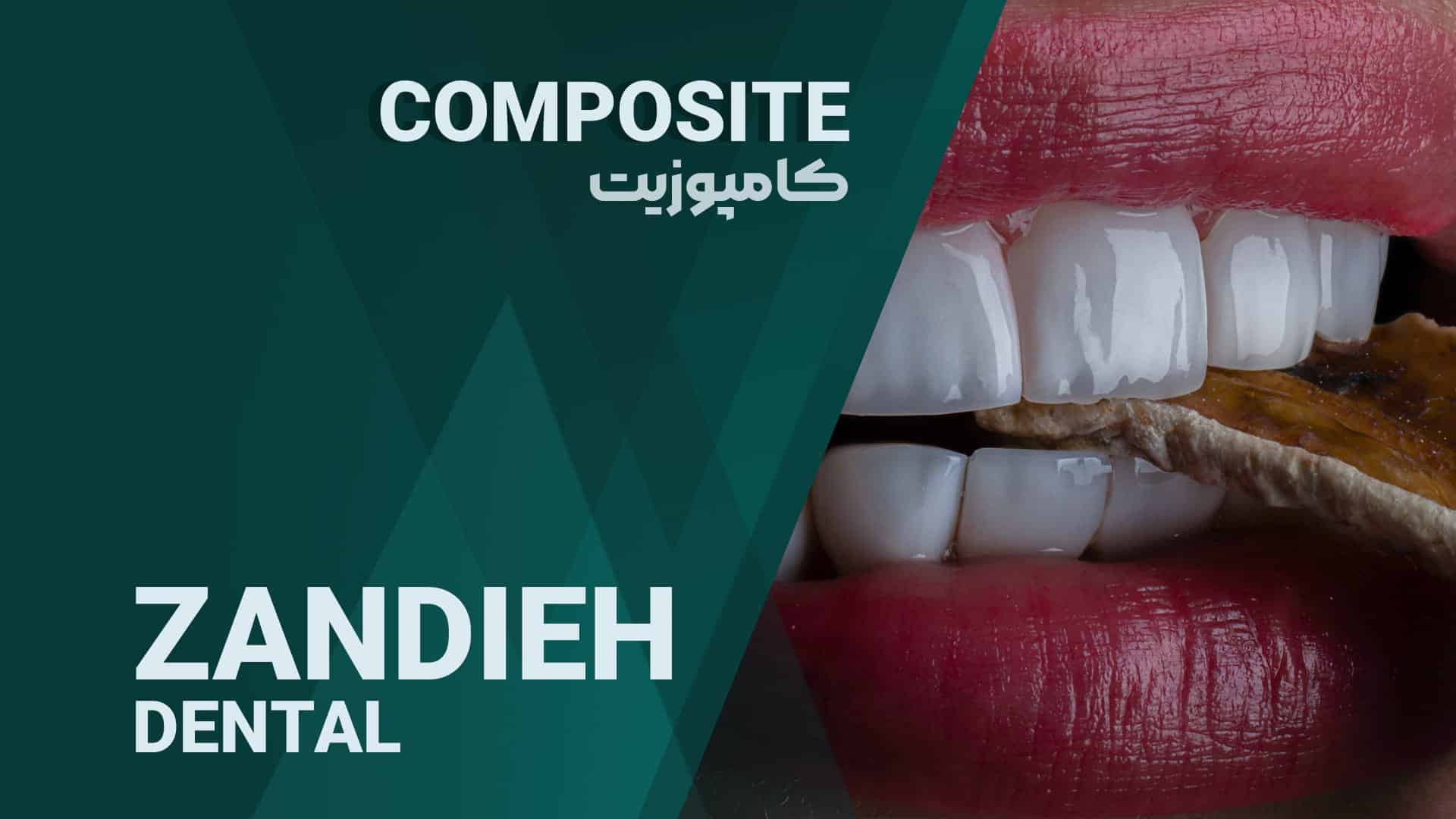 خدمات کامپوزیت در شیراز