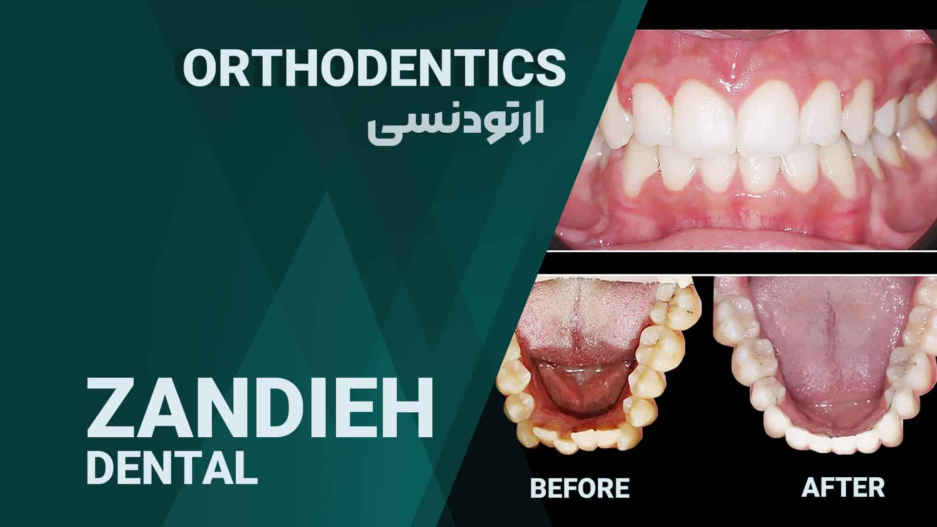 خدمات ارتودنسی دندان در شیراز