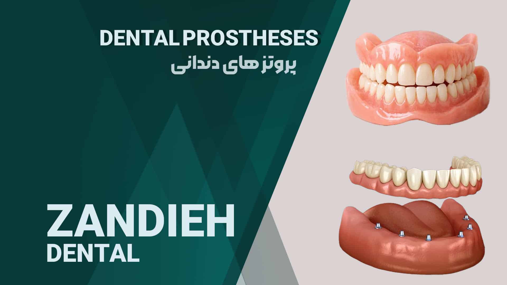 پروتز ثابت و متحرک در شیراز