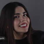 نمونه کار کامپوزیت دندان کلینیک زندیه 102