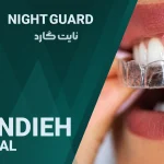 نایت گارد (محافظ دندان) در شیراز