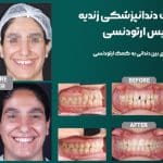 نمونه کار ارتودنسی کلینیک زندیه 55