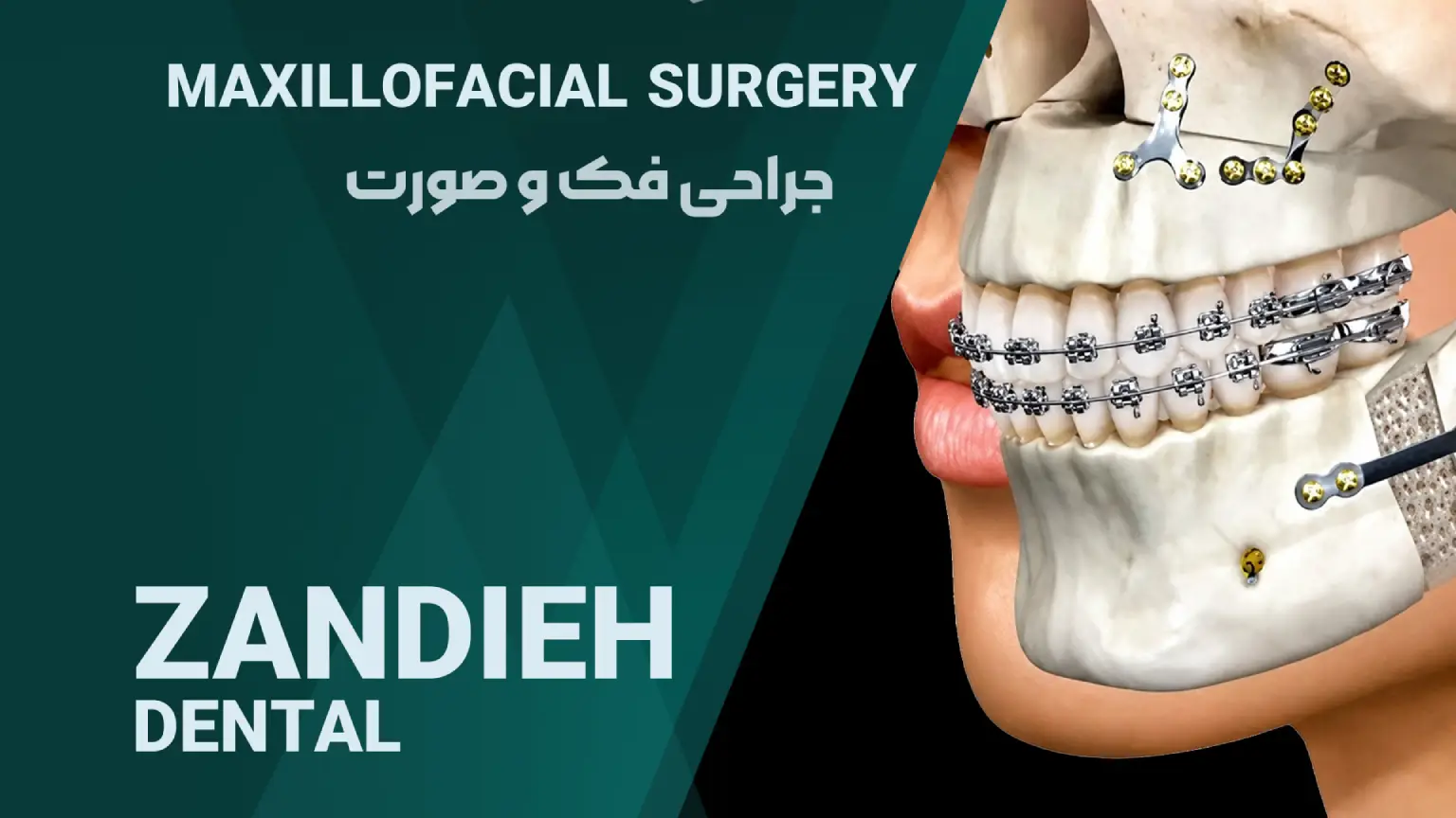 جراحی فک و صورت در شیراز