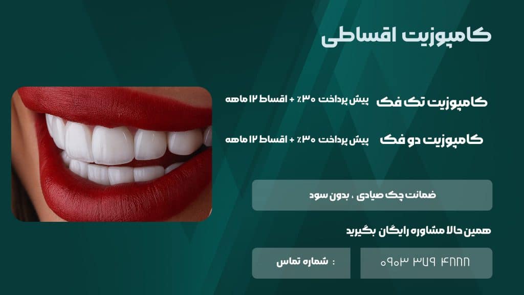 هزینه کامپوزیت اقساطی در شیراز کلینک زندیه