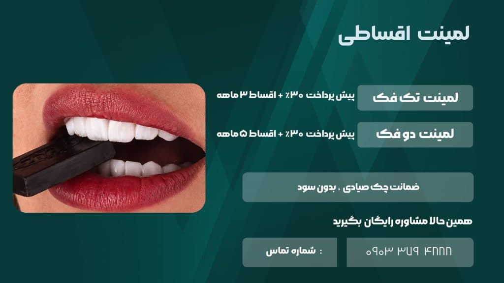 شرایط اقساط لمینت دندان در شیراز