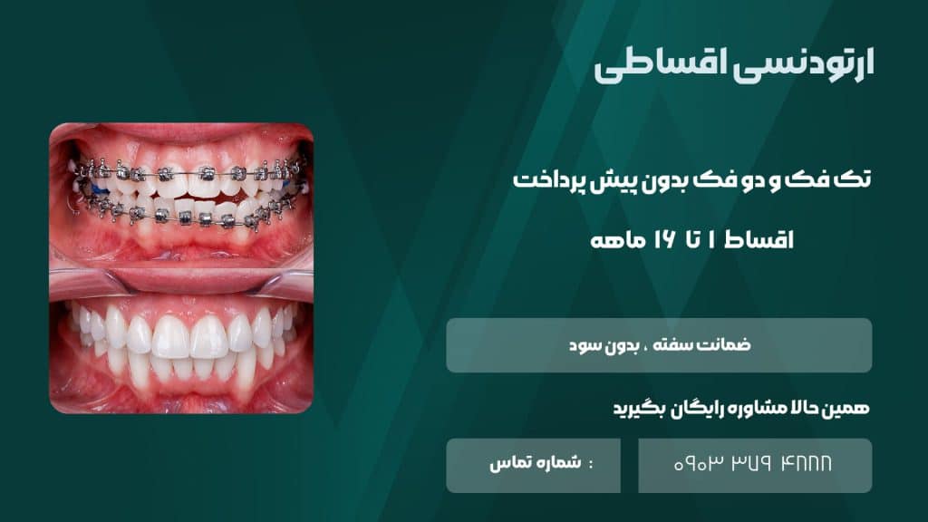 شرایط اقساط ارتودنسی دندان در شیراز