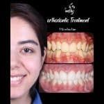نمونه کار ارتودنسی کلینیک زندیه 58