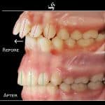 نمونه کار ارتودنسی کلینیک زندیه 56